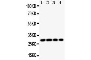 Anti-HLA DMB antibody, Western blottingAll lanes: Anti HLA DMB  at 0. (HLA-DMB 抗体  (Middle Region))