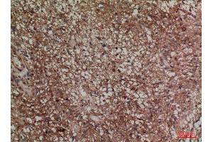 Immunohistochemistry (IHC) analysis of paraffin-embedded Mouse Brain, antibody was diluted at 1:100. (SNAP23 抗体  (C-Term))