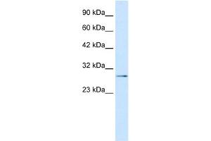 WB Suggested Anti-TBX20 Antibody Titration: 0. (TBX20 抗体  (N-Term))