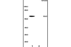Lane 1: mouse liver lysates Lane 2: rat brain lysates probed with Anti OAT-1/SLC22A6 Polyclonal Antibody, Unconjugated (ABIN670791) at 1:200 overnight at 4 °C. (Slco1a1 抗体  (AA 2-90))