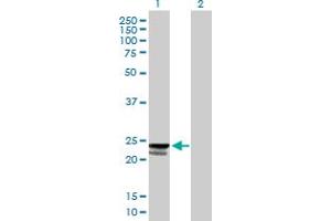Western Blot analysis of C9orf115 expression in transfected 293T cell line by C9orf115 MaxPab polyclonal antibody. (PTRH1 抗体  (AA 1-214))