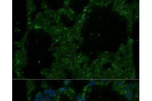 Immunofluorescence analysis of Rat lung using TREM2 Polyclonal Antibody at dilution of 1:100. (TREM2 抗体)