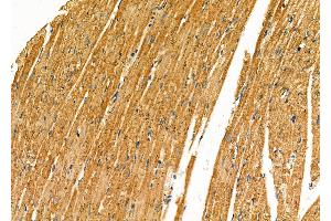 ABIN6259842 and ABIN6277280 at 1/100 staining Rat heart tissue by IHC-P.