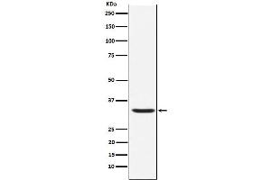 Western blot analysis of Hepcidin expression in Human Hepcidin Full-length Recombinant Protein (GFP Tagged).