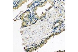 Immunohistochemical analysis of ETFA staining in human prostate formalin fixed paraffin embedded tissue section. (ETFA 抗体)