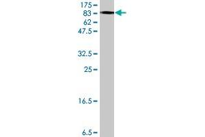 Western Blotting (WB) image for anti-Proteasome (Prosome, Macropain) 26S Subunit, Non-ATPase, 2 (PSMD2) (AA 1-908) antibody (ABIN562491)