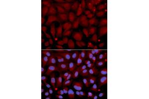 Immunofluorescence analysis of U2OS cells using BCHE antibody (ABIN5970682). (Butyrylcholinesterase 抗体)