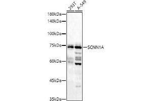 Western blot analysis of extracts of various cell lines, using (ABIN6129465, ABIN6147447, ABIN6147448 and ABIN6221186) at 1:1000 dilution. (SCNN1A 抗体  (AA 105-225))