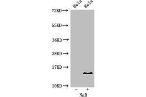 Western Blot Positive WB detected in: Hela cell acid extracts treated by NaB All lanes: HIST1H2BB antibody at 2 μg/mL Secondary Goat polyclonal to rabbit IgG at 1/50000 dilution Predicted band size: 14 kDa Observed band size: 14 kDa (HIST1H2BB 抗体  (acLys16))