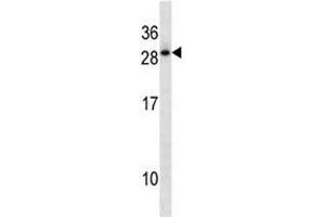 HOXD12 antibody western blot analysis in A549 lysate. (HOXD12 抗体  (AA 211-237))