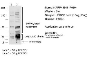 Sample: HEK293 cells (10ug, 50ug)Dilution: 1:1000