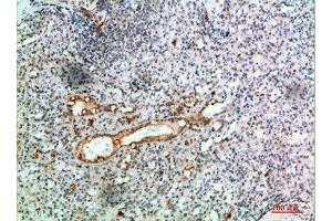 Immunohistochemistry (IHC) image for anti-Toll-Like Receptor Adaptor Molecule 1 (TICAM1) (AA 663-712) antibody (ABIN7189088)
