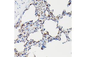 Immunohistochemistry of paraffin-embedded rat lung using SFTP Rabbit pAb (ABIN3017436, ABIN3017437, ABIN3017438 and ABIN6220091) at dilution of 1:50 (40x lens). (Surfactant Protein A1 抗体)