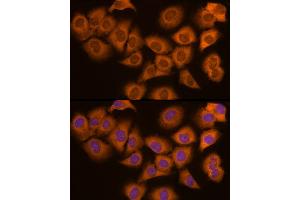 Immunofluorescence analysis of PC-3 cells using N Rabbit mAb (ABIN7268773) at dilution of 1:200 (40x lens). (NAT1 抗体)