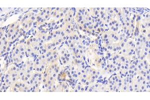 Detection of ACAT1 in Human Kidney Tissue using Polyclonal Antibody to Acetyl Coenzyme A Acetyltransferase 1 (ACAT1) (ACAT1 抗体  (AA 111-427))