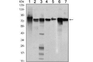 Western blot analysis using STAT5B mouse mAb against Hela (1), K562 (2), NIH/3T3 (3), C6 (4), HEK293 (5), Jurkat (6) and HL-60 (7) cell lysate. (STAT5B 抗体)