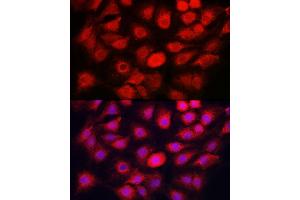 Immunofluorescence analysis of C6 cells using C Rabbit pAb (ABIN7266110) at dilution of 1:50 (40x lens). (Caspase 1 抗体)