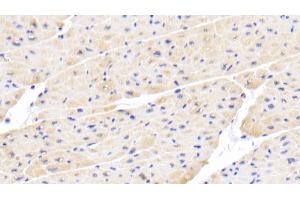 Detection of IL18 in Porcine Cardiac Muscle Tissue using Polyclonal Antibody to Interleukin 18 (IL18) (IL-18 抗体  (AA 36-192))