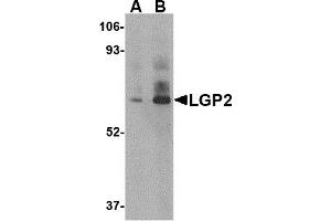 Western Blotting (WB) image for anti-DEXH (Asp-Glu-X-His) Box Polypeptide 58 (DHX58) (C-Term) antibody (ABIN1030481) (DHX58 抗体  (C-Term))