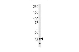 Western blot analysis of Annexin V antibody (C-term) (ABIN390502 and ABIN2840858) in SK-Br-3 cell line lysates (35 μg/lane). (Annexin V 抗体  (C-Term))