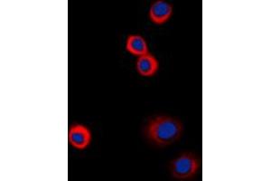 Immunofluorescent analysis of IGF1 Receptor (pY1161) staining in HeLa cells. (IGF1R 抗体  (C-Term, pTyr1161))