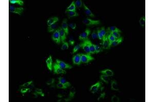 Immunofluorescence staining of HepG2 cells with ABIN7161004 at 1:33, counter-stained with DAPI. (NOX1 抗体  (AA 418-564))