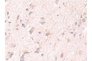 Detection of PGM1 in Human Cerebrum Tissue using Polyclonal Antibody to Phosphoglucomutase 1 (PGM1) (Phosphoglucomutase 1 抗体  (AA 1-235))