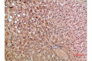 Immunohistochemical analysis of paraffin-embedded human-liver, antibody was diluted at 1:200 (CCR5 抗体  (AA 151-200))