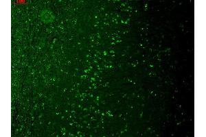 Immunohistochemistry (IHC) image for anti-Transient Receptor Potential Cation Channel, Subfamily M, Member 7 (TRPM7) (AA 1817-1863) antibody (APC) (ABIN2483113)