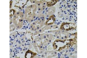 Immunohistochemistry of paraffin-embedded Rat kidney using AURKC Polyclonal Antibody (Aurora Kinase C 抗体)