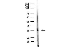 anti-BARX Homeobox 1 (BARX1) antibody