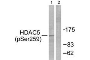 Western blot analysis of extracts from HepG2 cells, using HDAC5 (Phospho-Ser259) Antibody. (HDAC5 抗体  (pSer259))