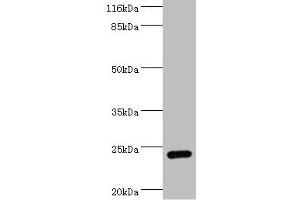 Western blot All lanes: STXBP6 antibody at 2 μg/mL + Mouse brain tissue Secondary Goat polyclonal to rabbit at 1/10000 dilution Predicted band size: 24, 12 kDa Observed band size: 24 kDa (STXBP6 抗体  (AA 2-210))