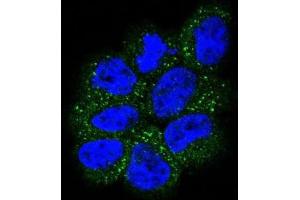 Immunofluorescence (IF) image for anti-GTPase NRas (NRAS) antibody (ABIN5023677) (GTPase NRas 抗体)