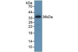 Western Blotting (WB) image for anti-C-Ros Oncogene 1 , Receptor tyrosine Kinase (ROS1) (AA 1945-2222) antibody (ABIN7427768)