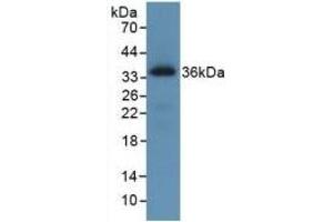 Detection of Recombinant ROS1, Human using Monoclonal Antibody to C-Ros Oncogene 1, Receptor Tyrosine Kinase (ROS1) (ROS1 抗体  (AA 1945-2222))