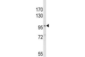 Western blot analysis of NLRP3 antibody and MDA-MB231 lysate (NLRP3 抗体  (AA 65-91))