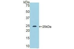 Detection of Recombinant DSC1, Mouse using Polyclonal Antibody to Desmocollin 1 (DSC1)