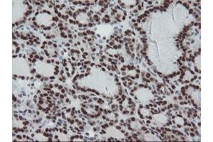 Image no. 7 for anti-TP53RK Binding Protein (TPRKB) antibody (ABIN1501484)