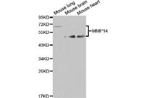 Western blot analysis of extracts of various cell lines, using MMP14 antibody.