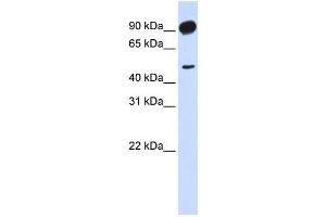 Adducin beta 2 antibody used at 1 ug/ml to detect target protein. (Adducin beta 2 抗体)