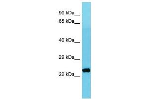 Host: Rabbit Target Name: MRPS26 Sample Type: Jurkat Whole Cell lysates Antibody Dilution: 1. (MRPS26 抗体  (C-Term))
