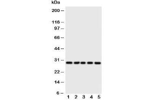Western blot testing of 14-3-3 sigma antibody and Lane 1:  HeLa;  2: A549;  3: A549;  4: COLO320;  5: SE620 cell lysate (14-3-3 sigma/SFN 抗体  (AA 140-156))