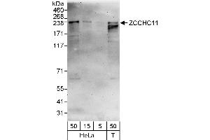 anti-Zinc Finger, CCHC Domain Containing 11 (ZCCHC11) (AA 250-300) antibody