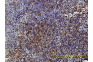 Immunoperoxidase of monoclonal antibody to GSDMDC1 on formalin-fixed paraffin-embedded human tonsil tissue. (GSDMD 抗体  (AA 1-484))