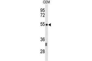 Western blot analysis of CENPI Antibody (Center) in CEM cell line lysates (35µg/lane). (CENPI 抗体  (Middle Region))