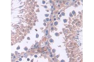 IHC-P analysis of Mouse Tissue, with DAB staining. (SHBG 抗体  (AA 219-358))