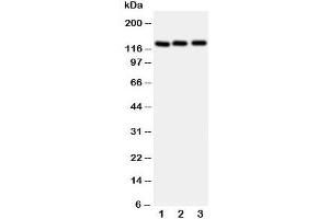 Western blot testing of Myosin Phosphatase antibody and Lane 1:  rat liver;  2: human 293T;  3: (h) HeLa cell lysate. (Myosin Binding Subunit 抗体  (N-Term))