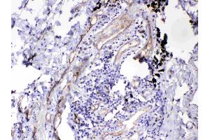 IHC analysis of HOMER3 using anti-HOMER3 antibody . (HOMER3 抗体  (AA 282-360))