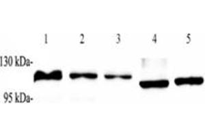 Western blot analysis of ZSCAN20 (ABIN7076252) at dilution of 1: 1000,Lane 1: Raji cell lysate,Lane 2: K562 cell lysate,Lane 3: HEK293 cell lysate,Lane 4: Mouse heart tissue lysate,Lane 5: Rat heart tissue lysate (ZSCAN20 抗体)
